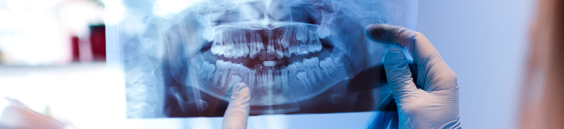 Warum sind Zahnarztbesuche wichtig